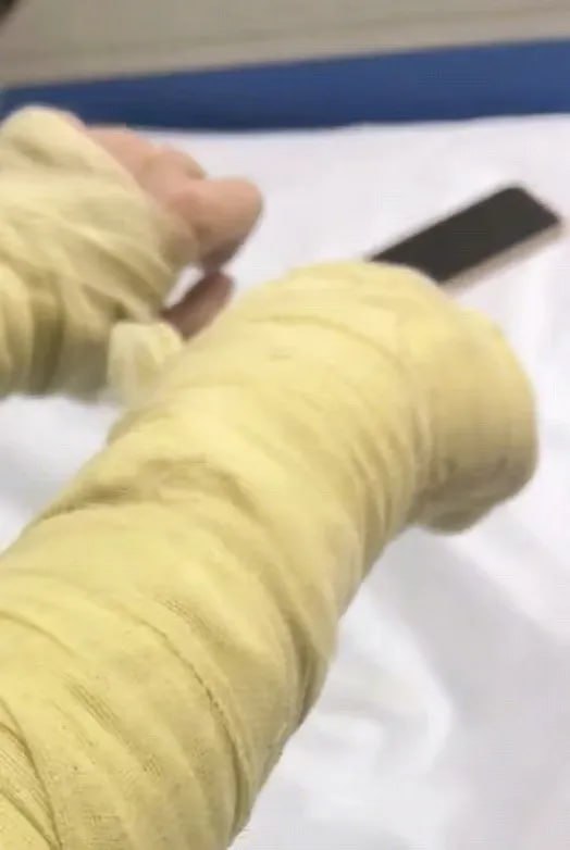 湖南一女主播收到炸弹包裹被炸伤10月16日，湖南一女主播收到炸弹包裹被炸伤引发热议