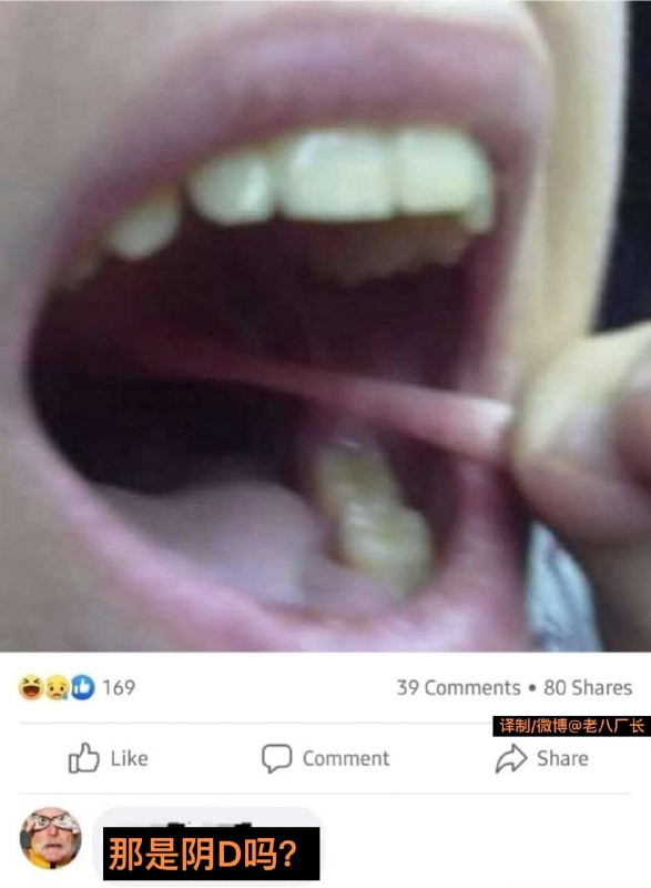 音蒂