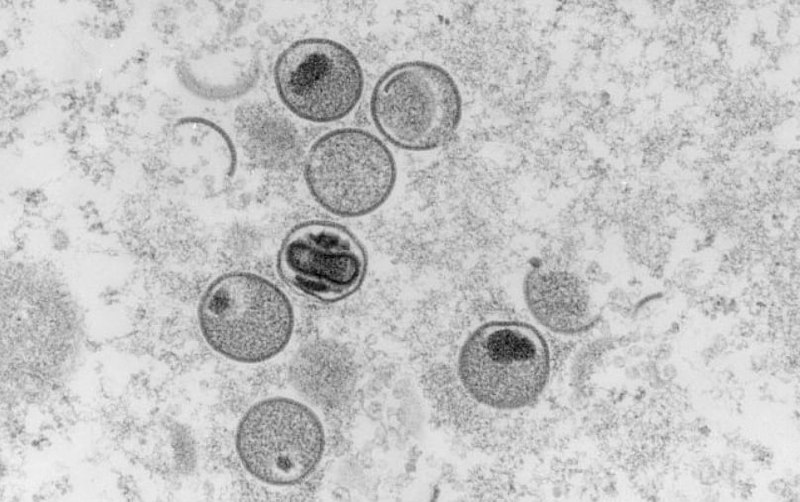 意大利男子同时感染新冠、猴痘和艾滋病毒据荷兰媒体BNO News当地时间23日报道，意大利报告了一例同时感染新冠病毒、猴痘病毒以及艾滋病毒的病例，这是目前已知的全球首例同时感染上述三种病毒的病例