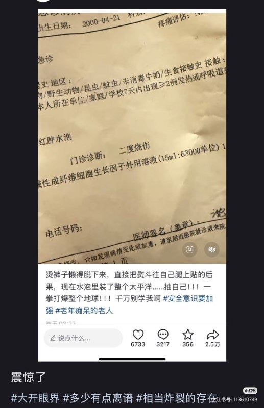 这是人？