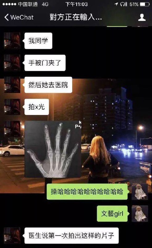 美甲后你的X光片会更美哦美甲后你的X光片会更美哦